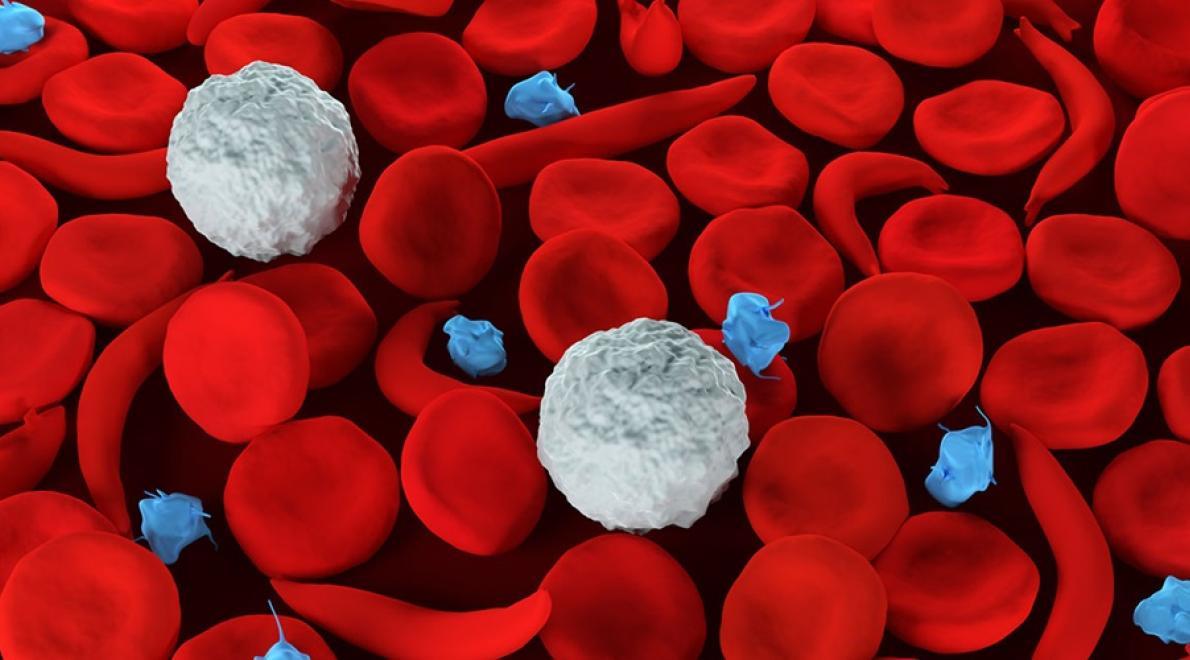 Sikkelcelfonds bezorgd over Amerikaanse bezuinigingen